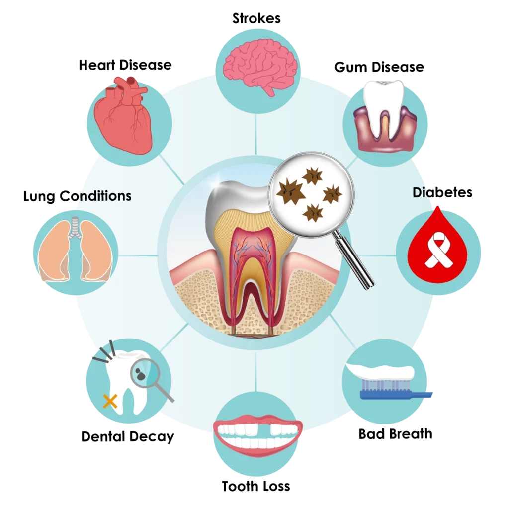 graphic of how to prevent periodontitis | best periodontal therapy near you